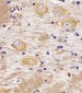 TAU Antibody (C-term)